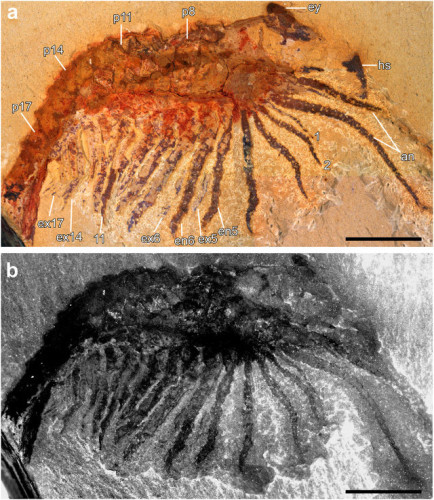 Xandarella spectaculum examined at light and fluorescence microscopy (Image courtesy Yu Liu)