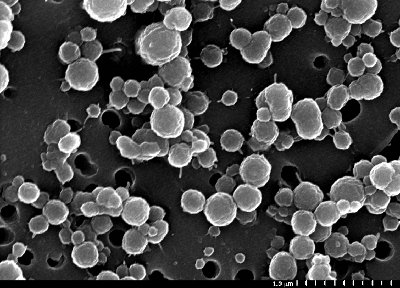 Scanning electron micrograph of bacteria from Lake Vida, Antarctica (Image Christian H. Fritsen, Desert Research Institute, all rights reserved)