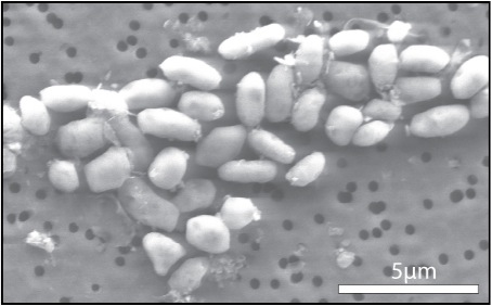 The bacterium GFAJ-1 grown in arsenic