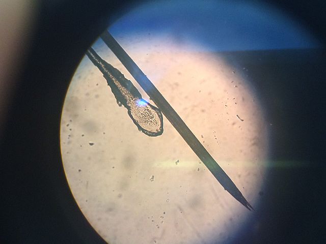 Hair bulb and extremity (Image Sly.cooper91)