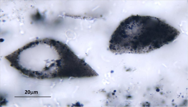 Kromberg Formation Microfossils (Image courtesy Dorothy Oehler)