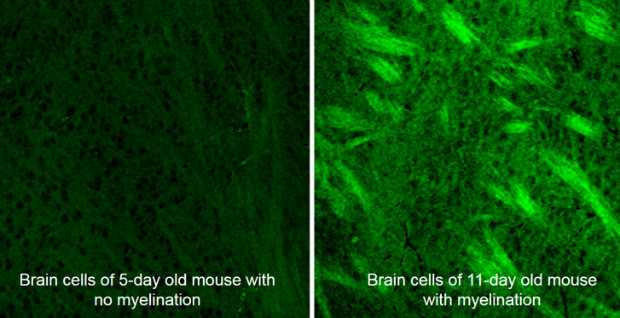 Mouse brain cells