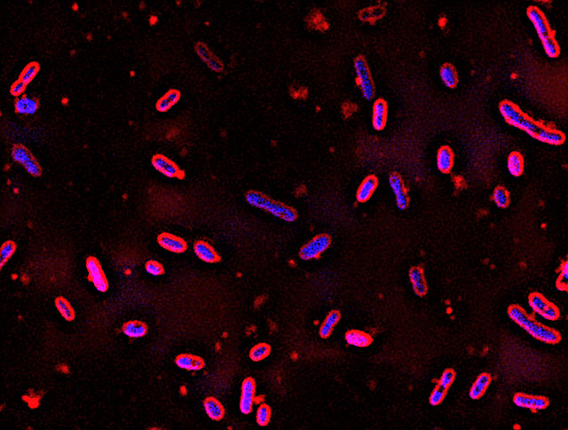 Novosphingobium aromaticivorans (Image GLBRC)