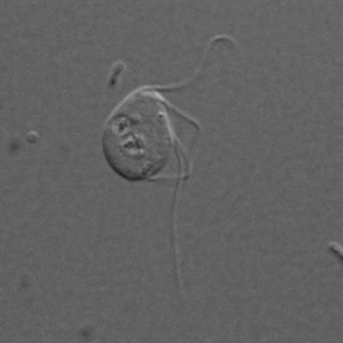 Light micrograph of Monocercomonoides sp. PA203 (Image courtesy Dr. Naoji Yubuki)